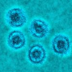 ebola