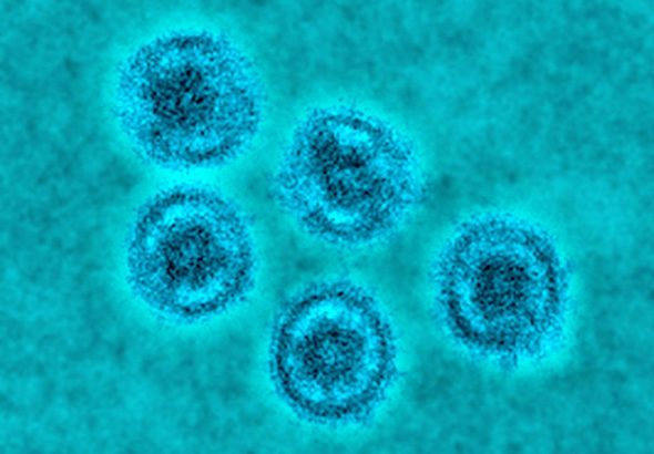 ebola