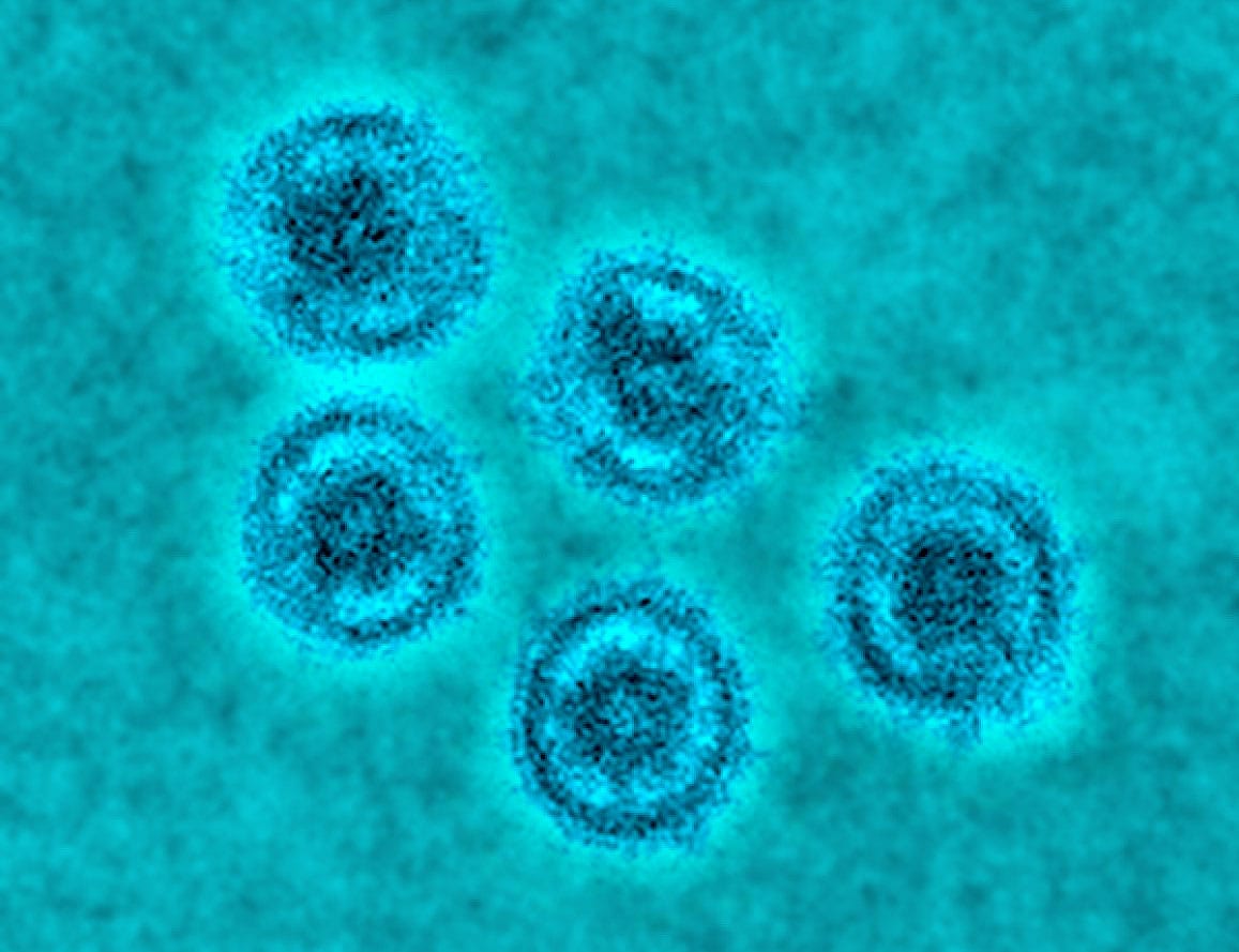 ebola